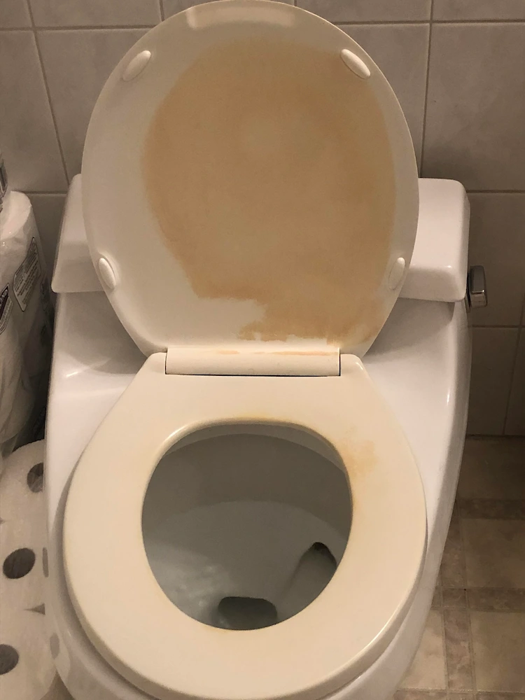 Es gibt eine Reihe von Ursachen für gelbe Flecken auf Toilettensitzen