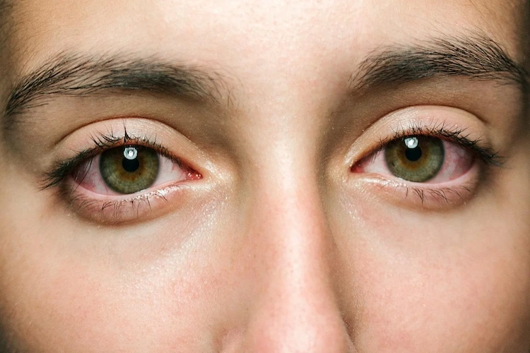 Augenschmerzen lindern mit Übungen - Wodurch wird eine Überanstrengung der Augen verursacht