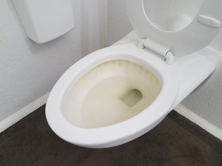 Stark verschmutzte Toilette Kalk und Urinstein reinigen