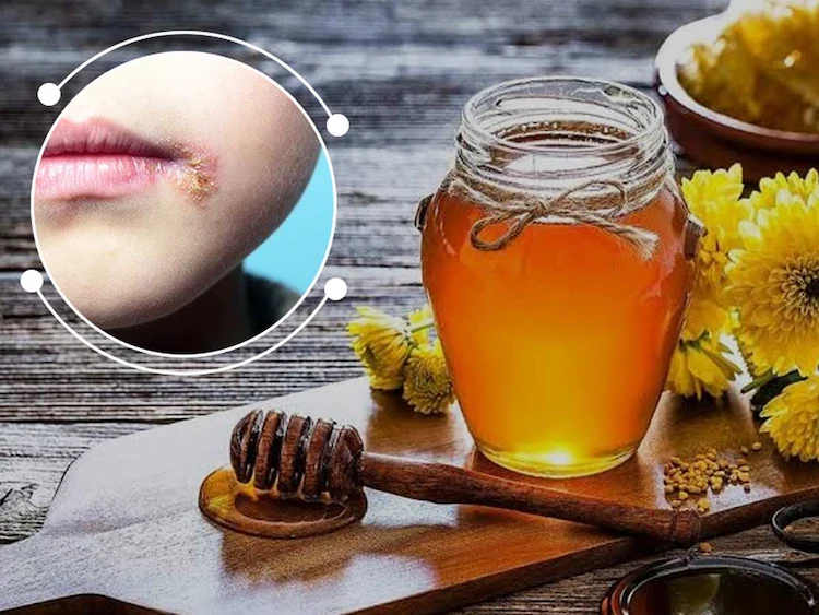 die heilende wirkung von honig als hausmittel gegen herpes bei menschen noch nicht bewiesen