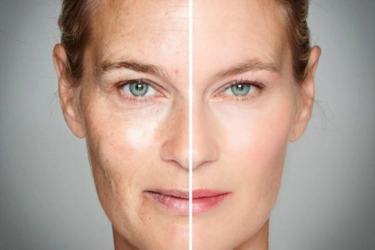 Make-up-Tricks, um jünger auszusehen - Wimpern schwingen - Bild vorher, nachher