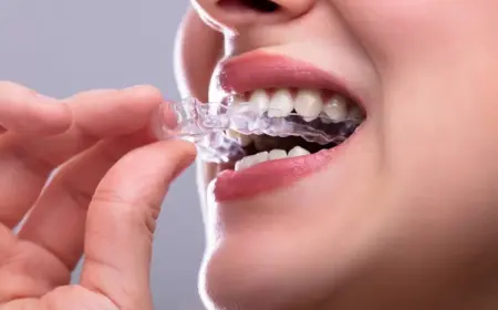 Wenn Sie mit den Zähnen knirschen, benutzen Sie wahrscheinlich eine Zahnschiene für die Nacht