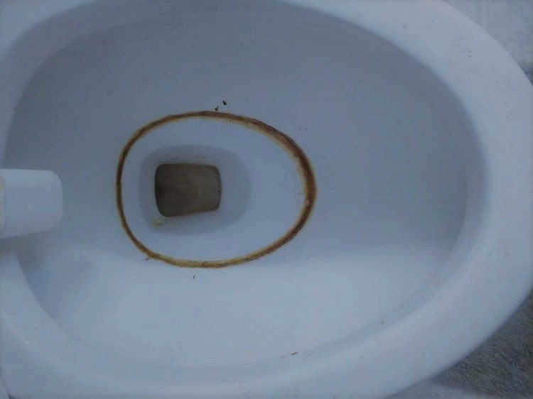 Stark verschmutzte Toilettenschüssel sauber machen mit Zitronensäure