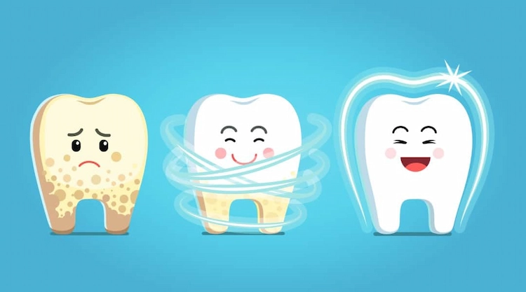 mit bestimmten hausmitteln und naturprodukten zu hause zahnstein selbst entfernen und zähne pflegen