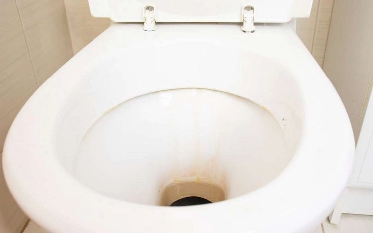Wie bildet sich Urinstein in Toilette