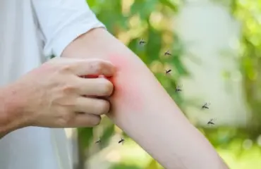 mücken von der terrasse vertreiben